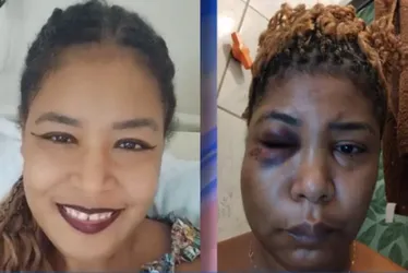 Imagem ilustrativa da imagem Técnica de enfermagem morre e família culpa agressões do marido
