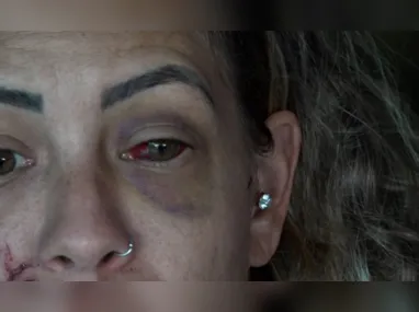Imagem ilustrativa da imagem "Chama a polícia!": dona de hostel apelou por socorro durante agressão