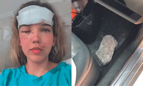 
          Imagem ilustrativa da imagem Advogada apedrejada na Rodovia do Sol vai para os EUA para não perder a visão
          