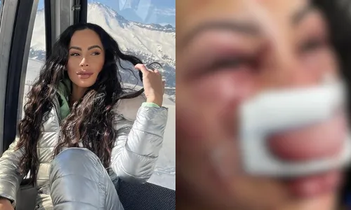 
          Imagem ilustrativa da imagem Brasileira é internada em estado grave após ser espancada no Chile
          