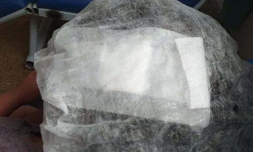 
          Imagem ilustrativa da imagem Canaletas quebradas provocam quedas e causam larvas em crianças do Recife
          