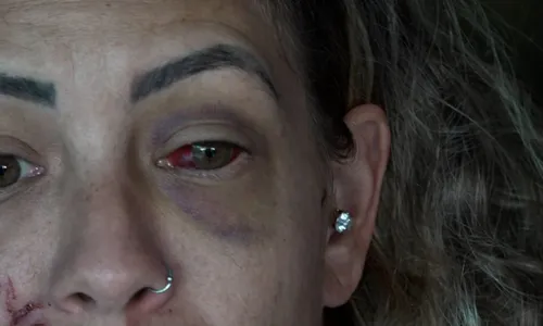 
          Imagem ilustrativa da imagem "Chama a polícia!": dona de hostel apelou por socorro durante agressão
          