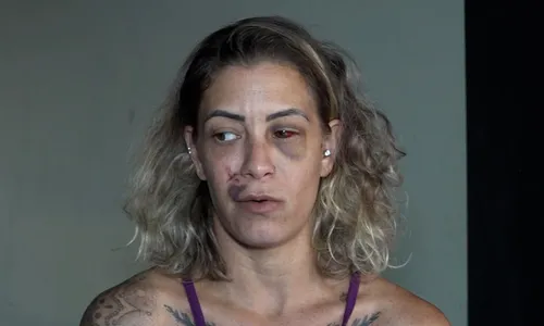 
          Imagem ilustrativa da imagem "Chama a polícia!": dona de hostel apelou por socorro durante agressão
          