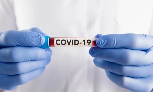 
          Imagem ilustrativa da imagem Covid aumenta risco de doenças como Alzheimer, dizem médicos
          