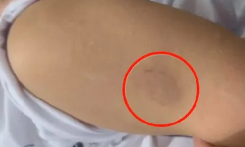 
          Imagem ilustrativa da imagem Cuidadora é demitida de creche após morder criança no Sul do ES
          