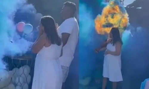 
          Imagem ilustrativa da imagem Dermatologista alerta para os perigos do “chá revelação”
          