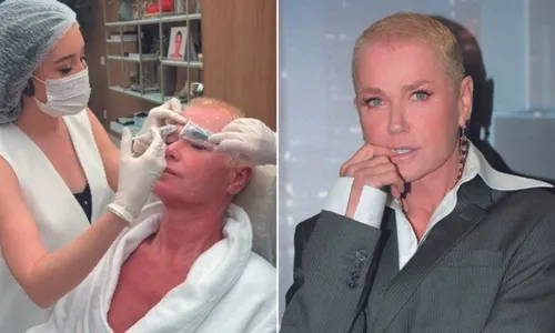 
          Imagem ilustrativa da imagem É possível fazer no mesmo dia 15 procedimentos estéticos?
          