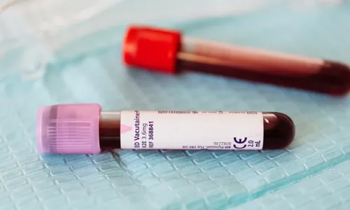 
          Imagem ilustrativa da imagem Exame para prever Parkinson antes dos sintomas
          