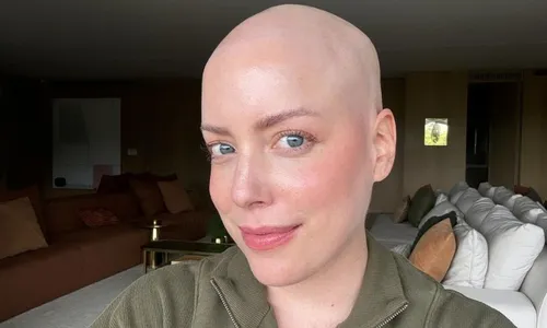 
          Imagem ilustrativa da imagem Fabiana Justus revela que realizou transplante pelo SUS: 'Dinheiro não compra'
          