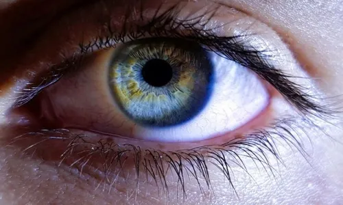 
          Imagem ilustrativa da imagem Glaucoma ameaça a visão de quase 100 milhões até 2030
          