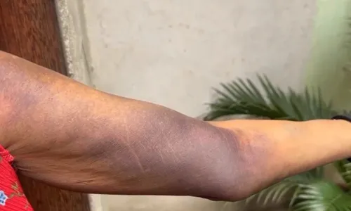 
          Imagem ilustrativa da imagem Homem é preso após agredir e obrigar mulher a usar drogas no ES
          