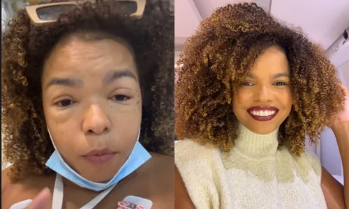 
          Imagem ilustrativa da imagem Jeniffer Nascimento faz alerta após ter reação alérgica com lagosta: 'Desesperador'
          