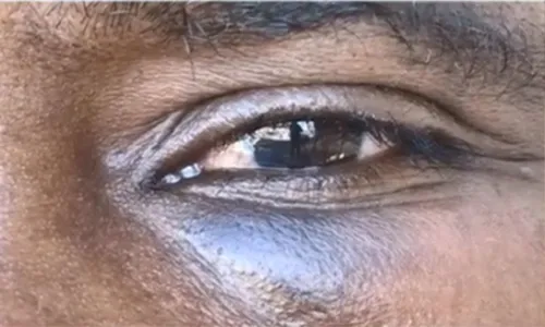 
          Imagem ilustrativa da imagem Lavrador é espancado durante tentativa de assalto em Cariacica
          