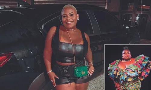 
          Imagem ilustrativa da imagem Médicos tiram dúvidas sobre cirurgia que fez Jojo Todynho perder 50 quilos
          