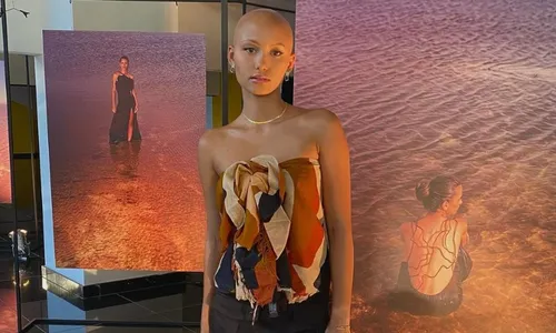 
          Imagem ilustrativa da imagem Modelo que nasceu careca desmistifica a alopecia
          