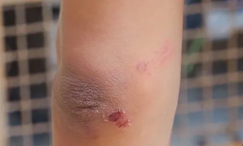 
          Imagem ilustrativa da imagem Mulher é agredida e tem nariz quebrado ao sair de festa em Vitória
          