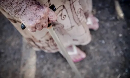 
          Imagem ilustrativa da imagem Ortopedistas alertam para risco de queda de idosos; saiba como evitar
          