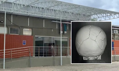 
          Imagem ilustrativa da imagem Bebê de um ano espancada pelo padrasto na Serra recebe alta
          