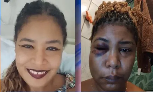 
          Imagem ilustrativa da imagem Técnica de enfermagem morre e família culpa agressões do marido
          