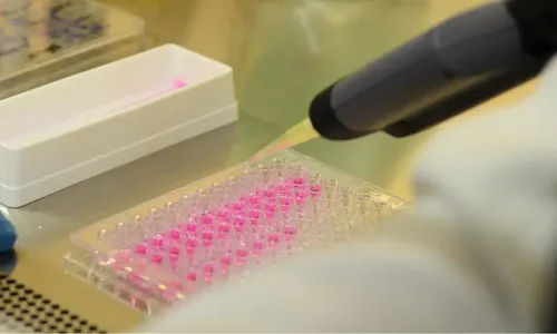 
          Imagem ilustrativa da imagem Vírus zika pode voltar a se replicar após recuperação, aponta estudo
          