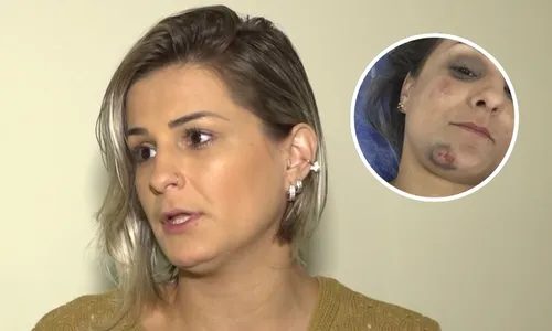 
          Imagem ilustrativa da imagem Vítima de acidente em moto por aplicativo no ES aciona Justiça para receber seguro
          