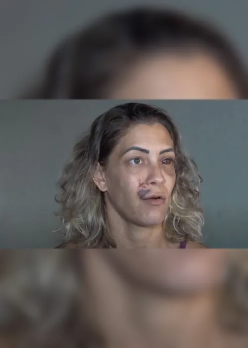 Imagem ilustrativa da imagem "Tentou me cegar", conta dona de hostel atacada por mochileira em Vila Velha