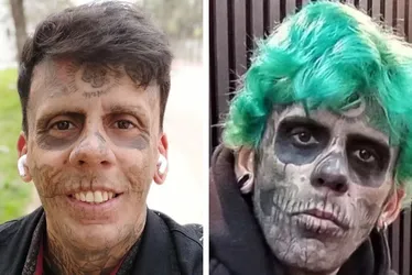 Imagem ilustrativa da imagem Agora evangélico, 'homem mais tatuado do Brasil' começa a remover tatuagens