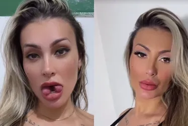 Imagem ilustrativa da imagem Andressa Urach revela custo de bifurcação na língua e diz que vai abrir igreja