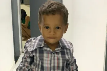 Imagem ilustrativa da imagem Criança de 2 anos morre após sofrer queimaduras em explosão de churrasqueira no ES