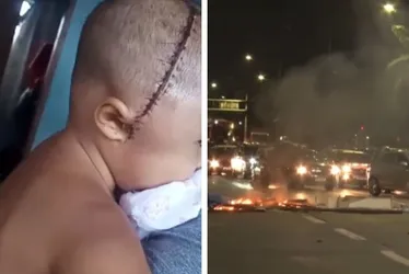 Imagem ilustrativa da imagem Moradores de Santo Amaro exigem Justiça após bebê sofrer agressão brutal
