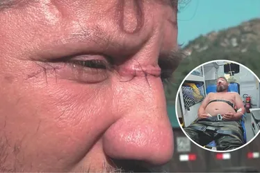 Imagem ilustrativa da imagem Motociclista é ferido por linha com cerol na Segunda Ponte