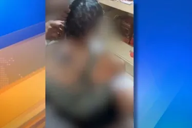 Imagem ilustrativa da imagem Mulher tem cabelo e sobrancelha raspados pelo ex-companheiro em Cariacica