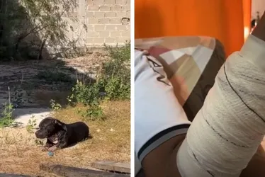 Imagem ilustrativa da imagem Pitbull é baleado depois de atacar homem no Sul do ES