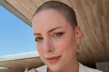 Imagem ilustrativa da imagem 'Ressignificar': Fabiana Justus celebra crescimento do cabelo após câncer