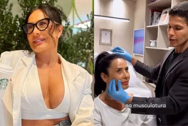 Imagem ilustrativa da imagem Desarmonização facial pode ser difícil, dolorosa, causar reação alérgica e flacidez