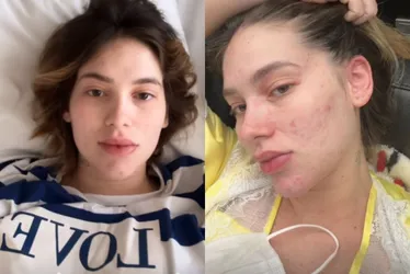 Imagem ilustrativa da imagem Virginia é internada às pressas e volta ao hospital menos de 24 horas após alta