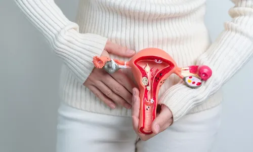 
          Imagem ilustrativa da imagem A luta quase invisível da mulher com endometriose
          