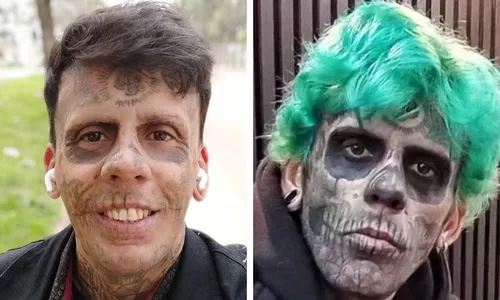 
          Imagem ilustrativa da imagem Agora evangélico, 'homem mais tatuado do Brasil' começa a remover tatuagens
          