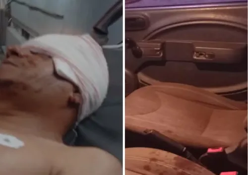 
          Imagem ilustrativa da imagem Após tentativa de roubo em Caruaru, homem fica com faca cravada na cabeça
          