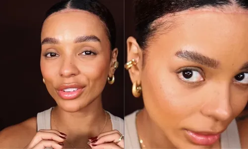 
          Imagem ilustrativa da imagem Brunna Gonçalves revela cicatriz de cirurgia para diminuição de testa
          