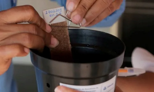 
          Imagem ilustrativa da imagem Dengue já matou 40 pessoas este ano no ES
          