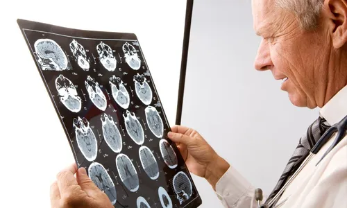 
          Imagem ilustrativa da imagem Estudo identifica tratamento promissor no combate a câncer cerebral sem cura
          