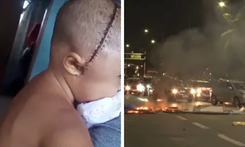 
          Imagem ilustrativa da imagem Moradores de Santo Amaro exigem Justiça após bebê sofrer agressão brutal
          