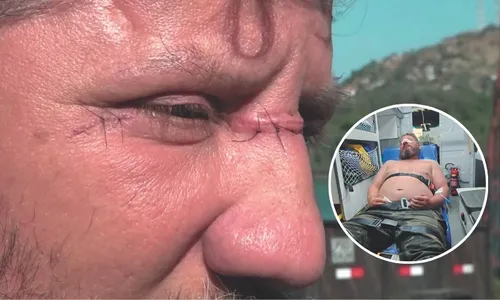 
          Imagem ilustrativa da imagem Motociclista é ferido por linha com cerol na Segunda Ponte
          