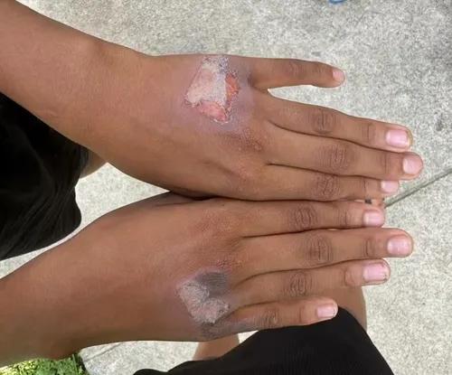 
          Imagem ilustrativa da imagem Mulher suspeita de queimar mãos do próprio filho com chapinha de cabelo
          