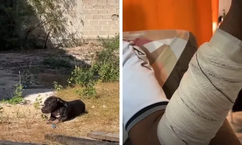 
          Imagem ilustrativa da imagem Pitbull é baleado depois de atacar homem no Sul do ES
          