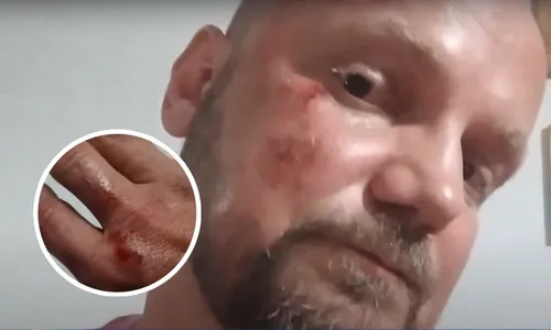 
          Imagem ilustrativa da imagem Professor fica ferido após ser atingido por madeira em ciclovia em Vitória
          