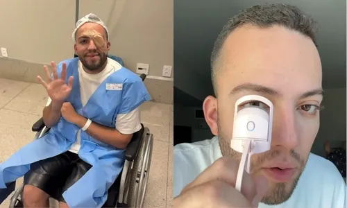 
          Imagem ilustrativa da imagem 'Terçol permanente' leva influencer a cirurgia após usar curvex; entenda infecção
          