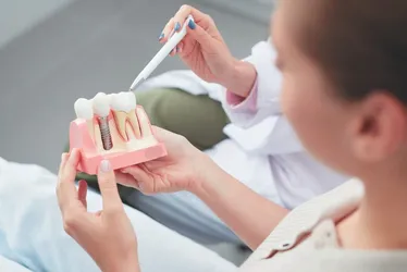 Imagem ilustrativa da imagem Empréstimo e até 13º salário para pagar implante dentário