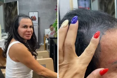 Imagem ilustrativa da imagem Gretchen surge sem prótese capilar e revela que 'perdeu todo o cabelo'